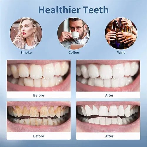 Smart Ultra-Sonic Teeth Cleaner