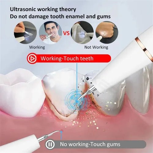 Smart Ultra-Sonic Teeth Cleaner